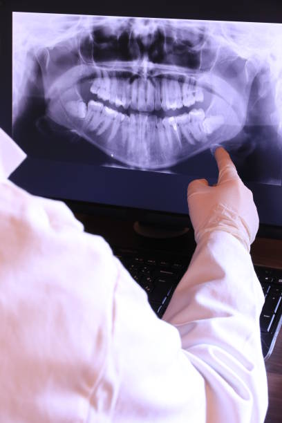 Best Emergency Dental Care for Broken or Chipped Teeth in Elon, NC